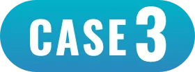 case3